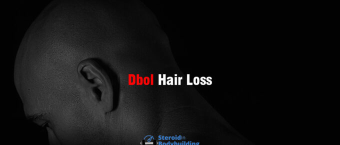 Dbol Hair Loss