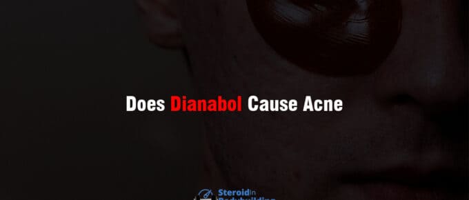 Does Dianabol Cause Acne