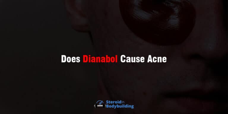 Does Dianabol Cause Acne? (REASON, PREVENTION & TREATMENT)